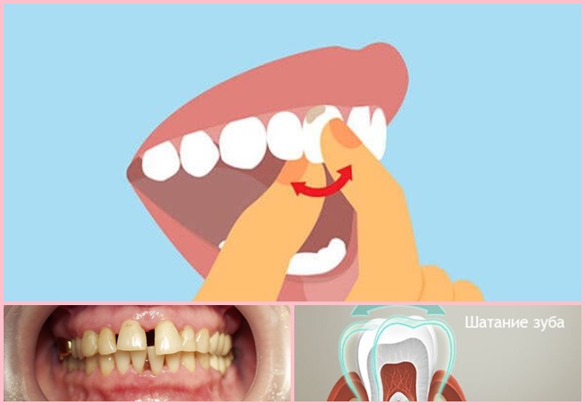 Что делать, если зубы стали шататься - отвечает магазин медтехники NOVOKOM.SU