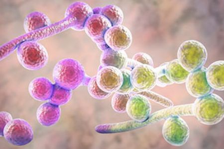 Кандидоз: только ли свечами лечится - мнение врача