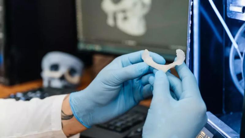 Томские ученые разработали новый подход к созданию имплантатов для костной ткани