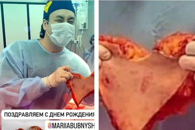 Шокирующая открытка: хирург из Новосибирска, вырезающий поделки из человеческой кожи, попал под статью